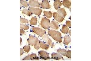 ARL17P1 Antibody (Center) (ABIN655544 and ABIN2845053) immunohistochemistry analysis in formalin fixed and paraffin embedded human skeletal muscle followed by peroxidase conjugation of the secondary antibody and DAB staining. (ARL17A Antikörper  (AA 102-130))