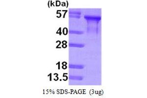 Microtubule-Associated Protein tau (MAPT) (AA 1-381) protein (His tag)