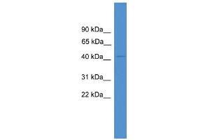 WB Suggested Anti-TXNIP Antibody Titration: 0. (TXNIP Antikörper  (Middle Region))