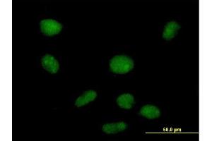 Immunofluorescence of purified MaxPab antibody to PHF19 on HeLa cell. (PHF19 Antikörper  (AA 1-207))