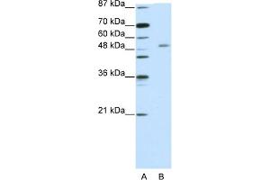 WB Suggested Anti-ZNF498 Antibody Titration:  5.