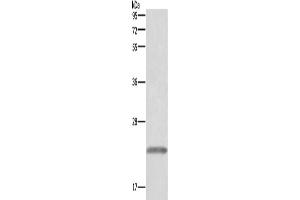 Western Blotting (WB) image for anti-Growth Hormone 1 (GH1) antibody (ABIN2822474)