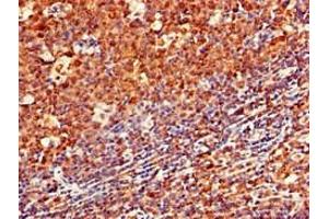 Immunohistochemistry of paraffin-embedded human tonsil tissue using ABIN7145141 at dilution of 1:100 (CD79a Antikörper  (AA 70-142))