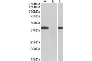 HEK293 lysate (10ug protein in RIPA buffer) overexpressing Human FANCF with C-terminal MYC tag probed with ABIN570912 (0. (FANCF Antikörper  (C-Term))