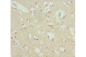 Immunohistochemistry of paraffin-embedded human brain tissue using ABIN7167437 at dilution of 1:100 (Receptor Accessory Protein 1 Antikörper  (AA 101-201))