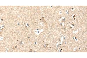 Immunohistochemistry of paraffin-embedded Human brain tissue using RRAD Polyclonal Antibody at dilution 1:50 (RRAD Antikörper)
