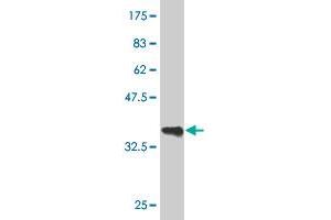 Western Blot detection against Immunogen (36. (GATA3 Antikörper  (AA 103-200))