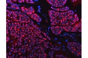 IF analysis of SNRPD2 using anti-SNRPD2 antibody (ABIN7598963).