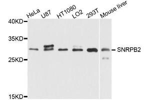 Western blot analysis of extracts of various cell lines, using SNRPB2 antibody (ABIN5995782) at 1/1000 dilution. (SNRPB2 Antikörper)