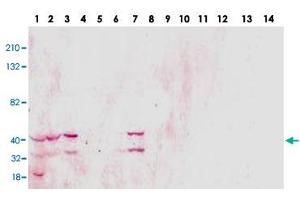 Western blot analysis of TSPY1 monoclonal antibody  in 14 different human cell lines. (TSPY1 Antikörper)