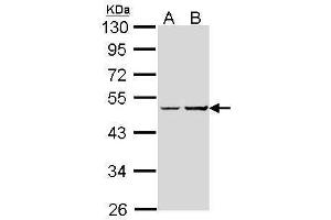 Western Blotting (WB) image for anti-GNAS Complex Locus (GNAS) antibody (ABIN2856886)