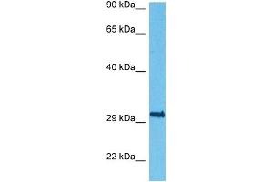 Western Blotting (WB) image for anti-Regulator of Calcineurin 1 (RCAN1) (Middle Region) antibody (ABIN2780590)
