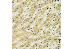Immunohistochemistry (Paraffin-embedded Sections) (IHC (p)) image for anti-Heat Shock 70kDa Protein 9 (Mortalin) (HSPA9) (AA 380-679) antibody (ABIN3021000)