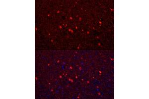 Immunofluorescence analysis of mouse brain using Calretinin Rabbit pAb (ABIN6129247, ABIN6137849, ABIN6137850 and ABIN6225108) at dilution of 1:250 (40x lens). (Calretinin Antikörper  (AA 1-271))