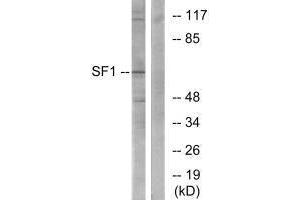 Western blot analysis of extracts from COLO205 cells, using SF1 (Ab-82) antibody. (Splicing Factor 1 Antikörper  (Ser82))