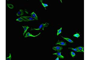 Immunofluorescent analysis of Hela cells using ABIN7149414 at dilution of 1:100 and Alexa Fluor 488-congugated AffiniPure Goat Anti-Rabbit IgG(H+L) (PLA2G4A Antikörper  (AA 379-533))