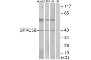Western Blotting (WB) image for anti-G Protein-Coupled Receptor, Family C, Group 5, Member B (GPRC5B) (AA 61-110) antibody (ABIN1535728)