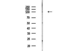 Western blot analysis of lysates from MCF7 cells(heat-shock,45 min treatment), using ATP6V0 Antibody at 1/1000 dilution.