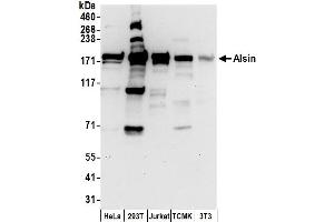 anti-Amyotrophic Lateral Sclerosis 2 (Juvenile) (ALS2) (AA 1250-1300) antibody
