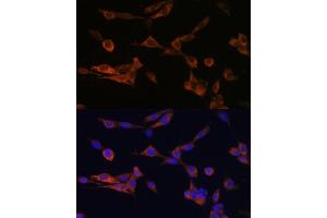 Immunofluorescence analysis of NIH-3T3 cells using YWHAH Polyclonal Antibody (ABIN6131142, ABIN6150348, ABIN6150349 and ABIN6224884) at dilution of 1:100 (40x lens). (14-3-3 eta Antikörper  (AA 1-246))