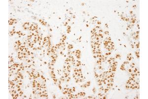 Immunohistochemistry (IHC) image for anti-RD RNA Binding Protein (RDBP) (AA 330-380) antibody (ABIN7448688) (RDBP Antikörper  (AA 330-380))