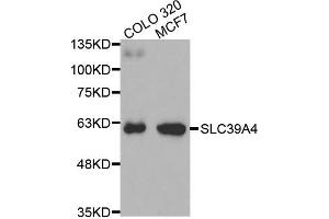 Western Blotting (WB) image for anti-Solute Carrier Family 39 (Zinc Transporter), Member 4 (SLC39A4) antibody (ABIN1874832) (SLC39A4 Antikörper)