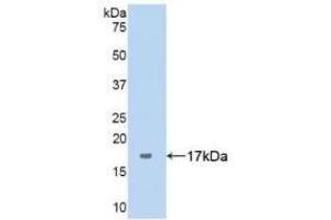 Western Blotting (WB) image for anti-Serpin Peptidase Inhibitor, Clade G (C1 Inhibitor), Member 1 (SERPING1) (AA 399-500) antibody (ABIN7431428)