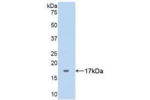 Detection of Recombinant ANXA5, Human using Polyclonal Antibody to Complement 1 Inhibitor (C1INH) (SERPING1 Antikörper  (AA 399-500))
