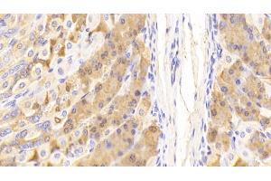 Detection of PGC in Mouse Stomach Tissue using Polyclonal Antibody to Pepsinogen C (PGC) (PGC Antikörper  (AA 17-392))