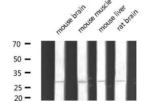 Western blot analysis of extracts of various tissue sample,using MYF5 Antibody . (MYF5 Antikörper  (N-Term))