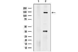 Western blot analysis of lysates from heat-shock treated EC304 cells, using Phospho-Met (Tyr1234) Antibody.