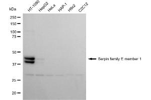 Western blotting analysis using serpin family E member 1 antibody (ABIN7799845). (Rekombinanter PAI1 Antikörper)