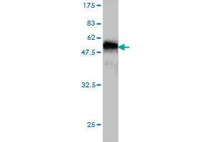 Western Blot detection against Immunogen (45. (PRKRIP1 Antikörper  (AA 1-184))