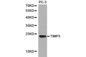 Western Blotting (WB) image for anti-TIMP Metallopeptidase Inhibitor 3 (TIMP3) antibody (ABIN1875099) (TIMP3 Antikörper)