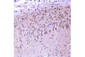 IHC analysis of cortactin using anti-cortactin antibody (ABIN6719306).