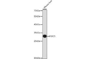 Western blot analysis of extracts of mouse liver, using FGF23 antibody (ABIN6133696, ABIN6140599, ABIN6140601 and ABIN6218305) at 1:1000 dilution. (FGF23 Antikörper  (AA 100-200))