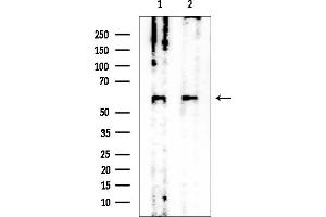 anti-Chondroitin Sulfate N-Acetylgalactosaminyltransferase 1 (CSGALNACT1) (Internal Region) antibody
