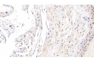 Detection of ROS1 in Human Placenta Tissue using Monoclonal Antibody to C-Ros Oncogene 1, Receptor Tyrosine Kinase (ROS1) (ROS1 Antikörper  (AA 1945-2222))