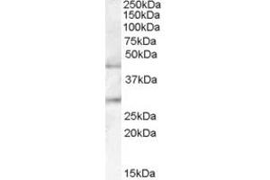 Image no. 1 for anti-UDP-GlcNAc:BetaGal beta-1,3-N-Acetylglucosaminyltransferase 2 (B3GNT2) (Internal Region) antibody (ABIN238559)