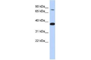 WB Suggested Anti-ZNF526 Antibody Titration:  0. (ZNF526 Antikörper  (N-Term))