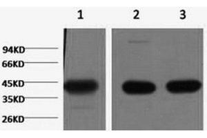 Western Blot analysis of 1) Hela, 2) Mouse brain, 3) Rat brain using ACTA1 Monoclonal Antibody at dilution of 1:1000. (Actin Antikörper)