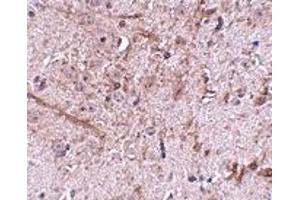 Immunohistochemistry (IHC) image for anti-Translocase of Outer Mitochondrial Membrane 70 (TOMM70A) (N-Term) antibody (ABIN1031635) (TOM70 Antikörper  (N-Term))