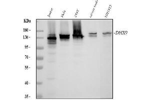 Western blot analysis of RNA Helicase A using anti-RNA Helicase A antibody (ABIN7606189).