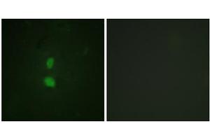 Immunofluorescence analysis of HuvEc cells, using SNAI1 (Phospho-Ser246) antibody. (SNAIL Antikörper  (pSer246))