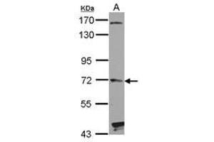 Image no. 1 for anti-Hedgehog Interacting Protein (HHIP) (AA 386-635) antibody (ABIN1498651)