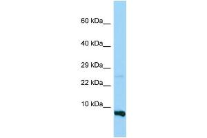 WB Suggested Anti-RPS28 Antibody Titration: 1.