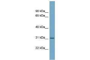 WB Suggested Anti-FGL1 Antibody Titration:  0. (FGL1 Antikörper  (Middle Region))
