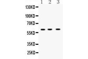 Western blot analysis of DR5 expression in rat thymus extract ( Lane 1), mouse cardiac muscle extract ( Lane 2) and K562 whole cell lysates ( Lane 3). (TNFRSF10B Antikörper  (AA 233-440))