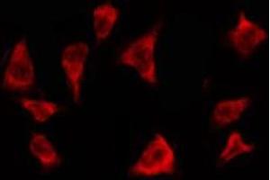 ABIN6278606 staining MCF7 by IF/ICC. (OR2T3/2T34 Antikörper)