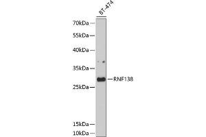 Western blot analysis of extracts of BT-474 cells, using RNF138 antibody (ABIN6128751, ABIN6147014, ABIN6147015 and ABIN6214506) at 1:1000 dilution. (RNF138 Antikörper)